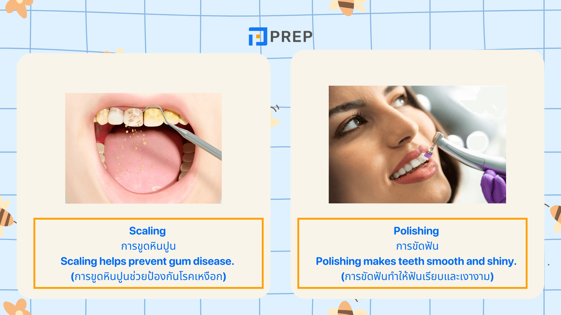 คำศัพท์ทันตกรรมในภาษาอังกฤษ รวมคำที่ใช้บ่อยในคลินิก