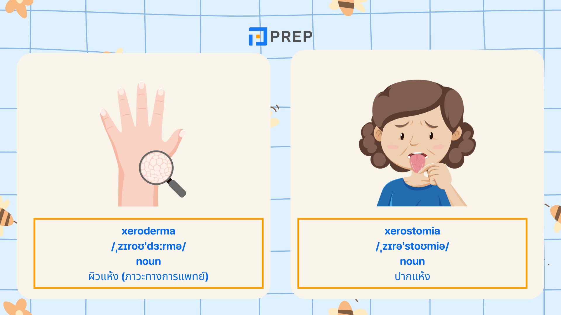 คำศัพท์ภาษาอังกฤษที่ขึ้นต้นด้วย X พร้อมความหมายและตัวอย่าง