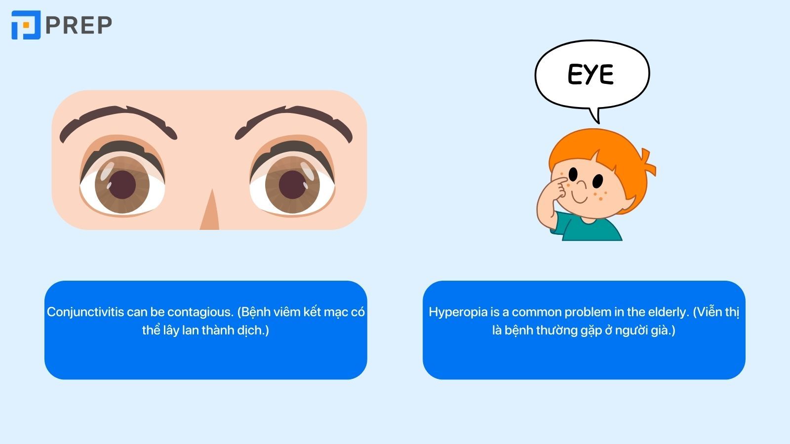 Từ vựng tiếng Anh về bệnh mắt