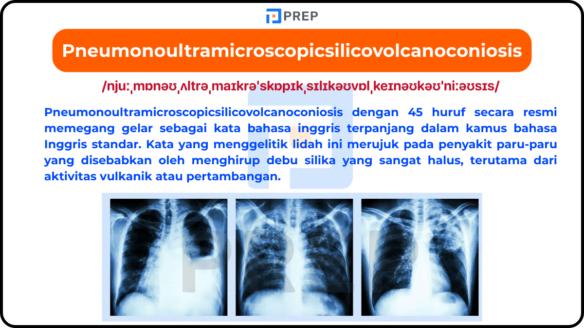 Apa Kata Terpanjang dalam Bahasa Inggris?